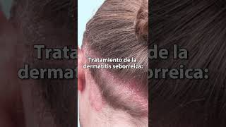 DERMATITIS SEBORREICA caspa TRATAMIENTO [upl. by Caiaphas]