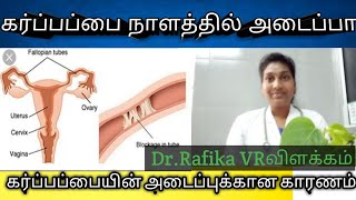 blockage in the fallopian tube in Tamil Obstruction in the fallopian tube Tamil [upl. by Alhak581]