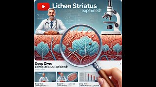 Lichen Striatus Comprehensive Guide to Diagnosis Features and Treatments [upl. by Atilrac]