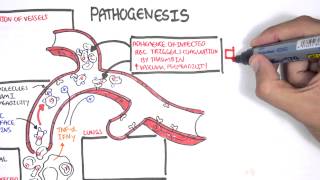 Malaria Pathophysiology [upl. by Shela]