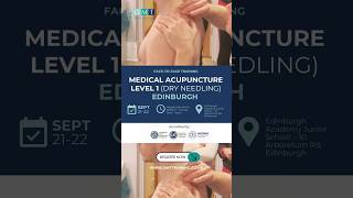 Back Pain Relief using Medical Acupuncture dry needling osteopathy backpain [upl. by Ilyk]