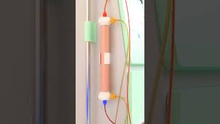 dialysis process animation dialysistechnician kidney bloodcleanser [upl. by Carter]