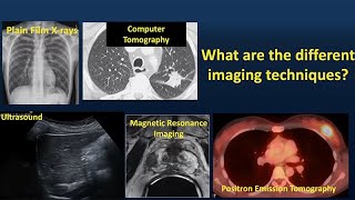 How is Cancer Diagnosed [upl. by Ellery396]