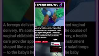 Forceps delivery [upl. by Zetana]