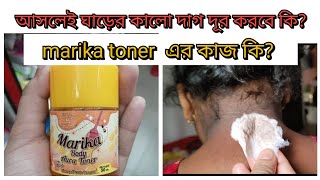 marika toner এর কাজ কিঘাড়ে ও বগলের কালো দাগ দূর করবে মারিকা টোনার 😘marika tonar [upl. by Chambers678]