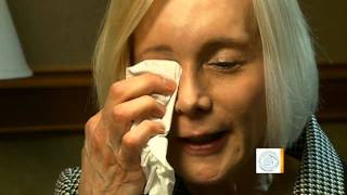 Eyelid surgery leaves woman unable to blink [upl. by Celinka187]