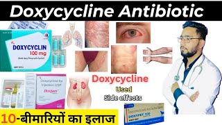 Doxycycline  एंटीबायोटिक  Medicine  Treatment  Antibiotics  doxycycline medicine Used [upl. by Eillah680]