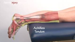 Achilles Tendonitis  Tendinopathy  Explained in 90 Seconds [upl. by Irrahs]