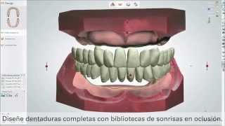 Novedades en Dental System™ 2014 [upl. by Ferullo]