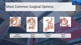 Weight Loss Surgery QampA Most Common Surgical Options [upl. by Kirad]