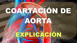 Coartación de la aorta [upl. by Nareht]