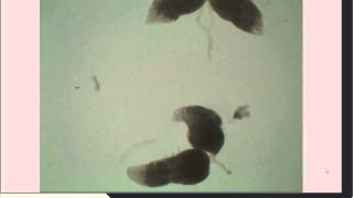 Drosophila Ovarian Dissection for Immunohistochemistry [upl. by Yrneh593]