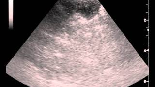 Dogs Ultrasound guided liver aspirate fenestration technique by Iowa Veterinary [upl. by Atsilac]