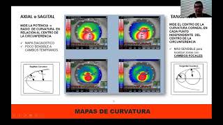 Curso de topografía corneal I Dr Angel Barroso  Dr Oscar Beaujon [upl. by Nadbus]