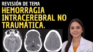 Revisión de Tema 44 Hemorragia Intracerebral No Traumática [upl. by Easton]