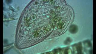 Blepharisma ciliate Contractile Vacuole in Action [upl. by Esirehc725]