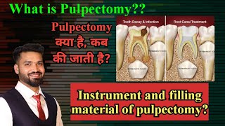 Pulpectomy Indication material used and procedure HINDI [upl. by Mylander]