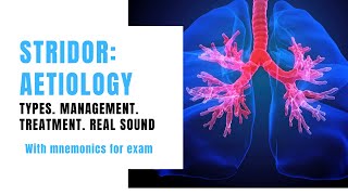 Stridor Sound  Aetiology with Mnemonics  Types Management  Treatment [upl. by Ysdnyl]