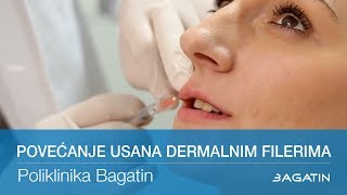 Povećanje usana dermalnim filerima [upl. by Leiria630]