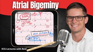 Atrial Bigeminy EKG  ECG Lecture [upl. by Ayhtak]