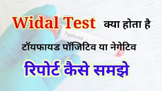 Widal test report reading in hindi  Widal test positive report  Widal Test in hindi [upl. by Haissem]