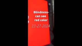 Blindness can see red color [upl. by Nooj15]