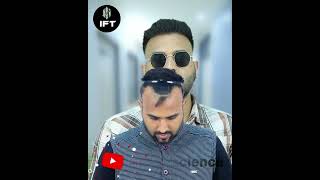 BEST PRP CENTER IN JAIPUR I PRP TREATMENT prptreatment hairtransplant hairfalltreatment [upl. by Danni831]