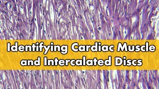 Fibrocartilage vs Cardiac Muscle Histology FAQ [upl. by Ahcsatan]