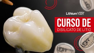 Disilicato de Litio Curso Lithium YZR [upl. by Cresa952]