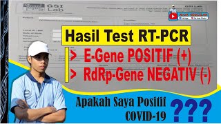 Cara Membaca Hasil Tes RTPCR Corona PCR real Times  RdRp gene Positif N gene Positif [upl. by Sugden232]