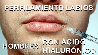 😎 LABIOS besables y atractivos en HOMBRES  ¡Lógralo así 😲 [upl. by Enilkcaj]