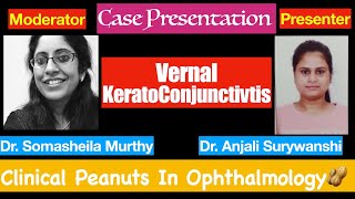 Clinical Peanuts in Case presentation  Vernal keratoConjunctivitis [upl. by Ahsar]