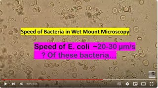 Speed of Bacteria in Wet Mount Microscopy Citrobacter farmeri Mag1600X [upl. by Claud]