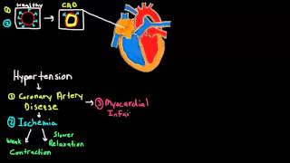 Pathophysiology of Heart Failure Part 1 [upl. by Nalda]