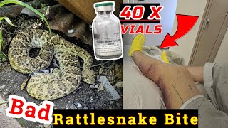 Rattlesnake Bite While Herping Central Texas [upl. by Quintilla]