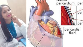 CONSTRICTIVE PERICARDITIS  RESTRICTIVE CARDIOMYOPATHY  PATHOLOGY [upl. by Areemas]