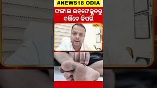 fungal infection treatment at home ଜାଣନ୍ତୁ ଏଥରୁ କିଭଳି ବର୍ତ୍ତିବେ local18 [upl. by Ameer172]