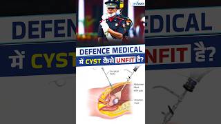 Can Cysts Cause Rejection in SSB Medical [upl. by Enaek31]