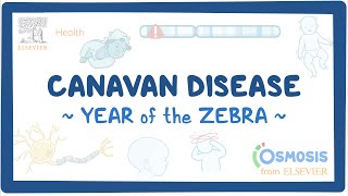 Canavan disease Year of the Zebra [upl. by Stark256]