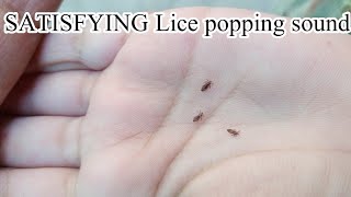 ASMR lice check asmr dailyhairroutine dailyvlog liceandnits usa USA [upl. by Egas]