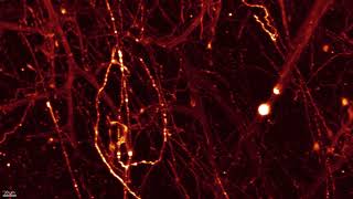 Glutamatergic neurons in the mouse brain sparse labeling [upl. by Niven]