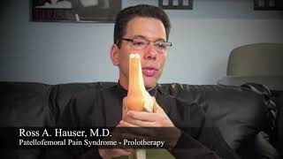 Patellofemoral Pain Syndrome treatment with Prolotherapy [upl. by Dahs529]