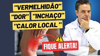 TROMBOFLEBITE entenda como um coágulo sanguíneo pode se tornar PERIGOSO ⚠️Dr Alex Vascular [upl. by Clinton]