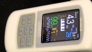 Monitoring of Pulse Oximetry and Capnography in a Cat [upl. by Weston]