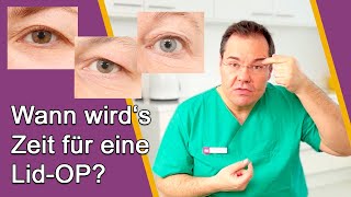 AugenlidOP – Ab wann ist OP sinnvoll Gibt es Alternativen ohne OP Dr Günther Düsseldorf [upl. by Ojaras]