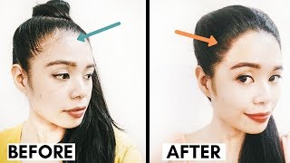 Methods Im Using to Grow Back a Fuller Hairline Receding Hairline Regrowth Beautyklove [upl. by Merrily]