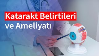 Katarakt Belirtileri ve Ameliyatı  Medical Park [upl. by Siroled664]