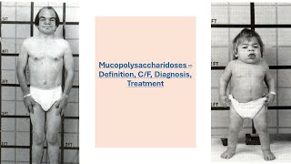 Mucopolysaccharidosis Biochemistry  Mucopolysaccharidosis [upl. by Dirgni748]