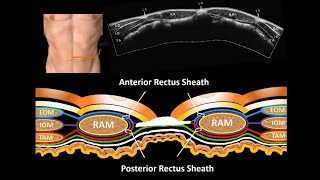 Formation of Rectus Sheath amp Rectus Sheath Block RSB [upl. by Argile]