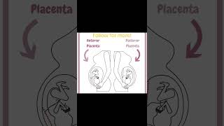 Why Your Placenta Location Matters [upl. by Berkie20]